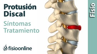 Protrusión de disco o discal  Qué es causas síntomas y tratamiento [upl. by Gomez211]