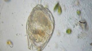 Rotifer  Lecane hamata [upl. by Staford278]