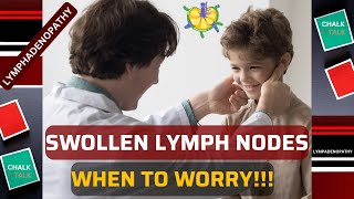 SWOLLEN LYMPH NODES LYMPHADENOPATHY [upl. by Marlee950]