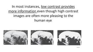 RADS102 Contrast [upl. by Hnad]