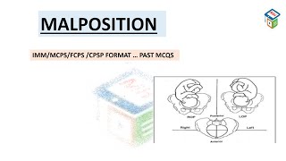 MALPOSITION  IMM  MCPS  CPSP  PAST MCQS [upl. by Argella]