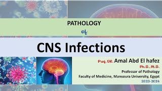 CNS Infections HUE شرح محاضرة Rabies PolioMeningitsEncephalitisBrain Abscess Prion Diseases [upl. by Edris373]