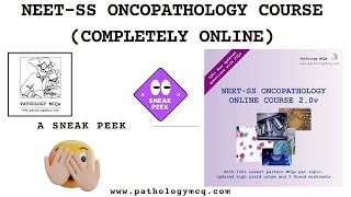 NEETSS ONCOPATHOLOGY COURSE wwwpathologymcqcom [upl. by Rambow]