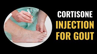 Cortisone Injection For Gout [upl. by Tserof]