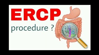 What is ERCP Procedure  deeply Explain about Endoscopy retrograde colangiopancreatography [upl. by Fitalludba438]