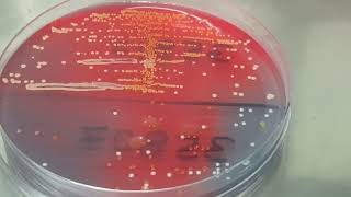 Staphylococcus saprophyticus colony morphology on CLED agar [upl. by Aitam]