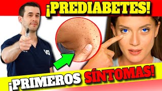 PREDIABETES y RESISTENCIA a INSULINA SÍNTOMAS INICIALES [upl. by Shargel248]