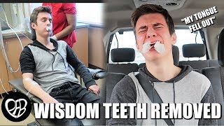 quotMY TONGUE FELL OUTquot  GETTING MY WISDOM TEETH REMOVED  HE GOT HIS WISDOM TEETH OUT with ANESTHESIA [upl. by Areht]