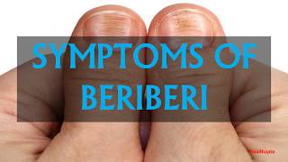 SYMPTOMS OF BERIBERI [upl. by Ahsaeym]