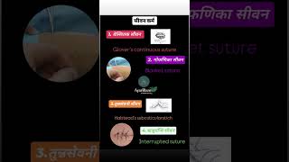 types of suture acc to acharya sushrut 🙏aiapgetayurveda aiapgetstrategies [upl. by Mehsah]