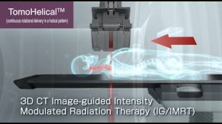 TomoTherapy® H series [upl. by Vidal]