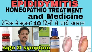 Epididymitis symptoms cause and cured by homeopathic medicineअंडकोष में दर्द और सूजन को ठीक करे [upl. by Llehcim]