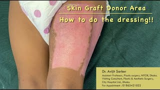 Skin graft donor area How to do the dressing [upl. by Akehsat]