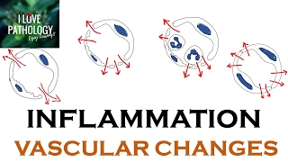 INFLAMMATION Part 1 General concepts types  Vascular changes in Acute inflammation [upl. by Green]