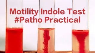 Motility Indole Patho Bacterial Motility Indole test [upl. by Letch3]