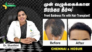 Male pattern baldness  Best hair Transplant in Chennai  Book Consultation 8825581472 [upl. by Aloek]