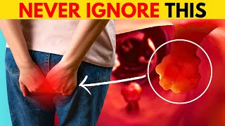 7 Signs and Symptoms Of Colon Cancer MUST WATCH [upl. by Anilahs]