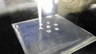 Ouchterlony Double Diffusion for Antibody Titration  Amrita University [upl. by Artus]