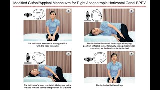 Modified GufoniAppiani Manoeuvre for Right Apogeotropic Horizontal Canal BPPV [upl. by Ahselyt]