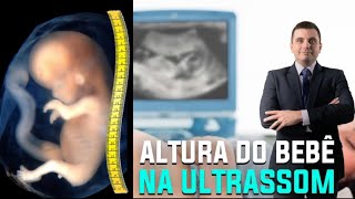 É Possível ver a Altura Estatura do Bebê pelo Ultrassom [upl. by Nadnal152]