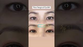 OneWeek Transformation NonSurgical Eyelift with Plasma Fibroblast for Hooded amp Aging Eyes [upl. by Edya]