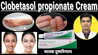 Clobetasol Cream ip tenovate  Clobetasol propionate cream [upl. by Anuqahs]