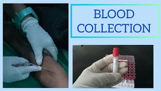 EASY WAY TO DRAW BLOOD।। BLOOD SAMPLE PROCEDURE ।। HOW TO TAKE BLOOD FROM VEIN ।। [upl. by Kirred775]