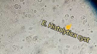 Entamoeba Histolytica trophozoite cyst Stool examination stoolanalysis gse stooltest [upl. by Cornwell]