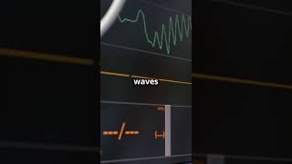 Hyperkalemia ECG Changes and Emergency Treatment medicaleducation medicalstudent DiagnosticLens [upl. by Droc]