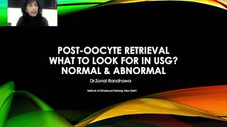 Post oocyte retrieval What to look for in USG [upl. by Aramoiz254]