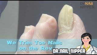 We Trim Toe Nails on quotThe Revquot Is Trimming Toenails Feel Good [upl. by Ydna]