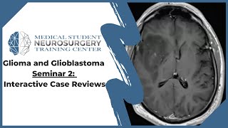 Glioma and Glioblastoma Seminar 2 Interactive Case Reviews [upl. by Ardnazxela12]