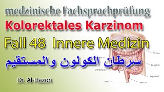 Kolonkarzinom Kolorektales Karzinom Innere Medizin medizinische Fachsprachprüfung سرطان المستقيم [upl. by Aiynot]