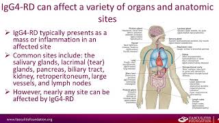 IgG4 Related Disease [upl. by Peterman]