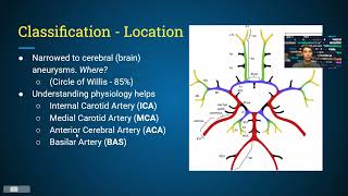 How to Make an Aneurysm Embolization Device [upl. by Okomom]