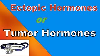 ectopic hormone produced by tumor or cancer [upl. by Lesirg]