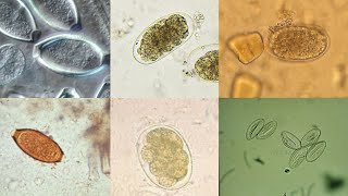 Clinical Parasitology Laboratory  Intestinal Nematode Egg Identification [upl. by Heidt]