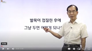 발질환 무엇이든 물어보세요 발목 접질린 후에 그냥 두면 어떻게 되나요 [upl. by Bandler]