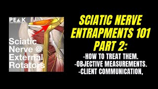 Sciatic Nerve Entrapment Treatment Demonstration Using Manual Scar Tissue Treatment [upl. by Wilcox]