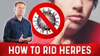 How To Get Rid Herpes Virus with Autophagy Fasting  Dr Berg [upl. by Noeled]