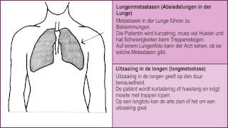 Wenn man nicht mehr gesund wird  Metastasen in Knochen Lunge Leber und Gehirn 26 [upl. by Ainivad522]