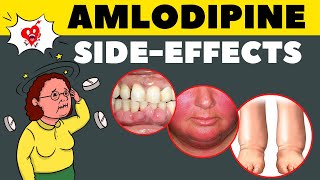 Amlodipine Side Effects amp How to Avoid  Amlodipine Adverse Effects [upl. by Mavilia]