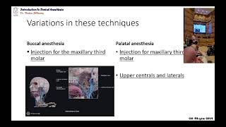 03 variations in the maxillary local infiltration techniques [upl. by Halette669]