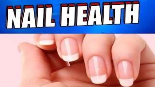 What Your Nails Reveal about Your Health [upl. by Keisling]