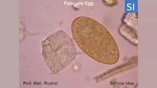 Fasciola egg [upl. by Brookner]