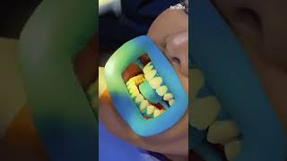 Vina Anggi Sitorus Dental Treatment at Farmanina Dental [upl. by Seira553]