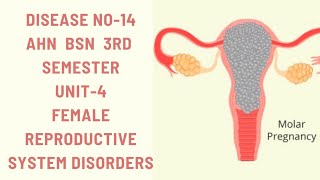 Hydatidiform MoleMolar pregnencyDisease14AHNBSN 3rdsemester Unit4female reproductive disorders [upl. by Jecon]