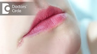 What is Angular Cheilitis Symptoms Causes Treatment [upl. by Aihsoem958]