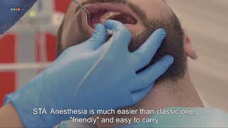 Painless Computerized Dental Anesthesia at Neoclinique EN [upl. by Renferd658]