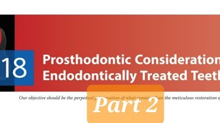 Prosthodontic Considerations in RCT Treated Teeth 2Factors affecting post selectionTypes of Posts [upl. by Brig]